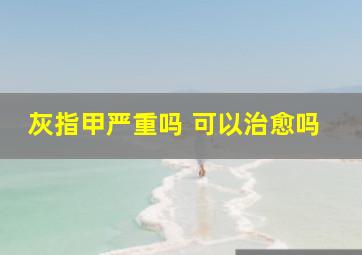 灰指甲严重吗 可以治愈吗